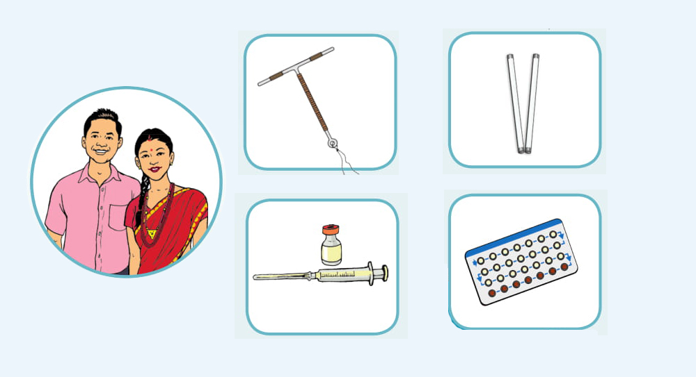 कसले कुन परिवार नियोजनको अस्थायी साधन प्रयोग गर्नु उचित हुन्छ ?